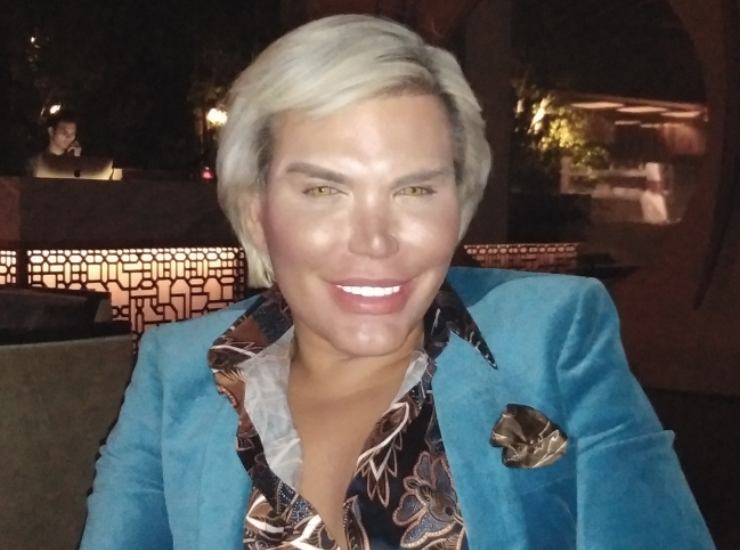 Rodrigo Alves chi e | curiosita | interventi chirurgici del Ken umano - meteoweek