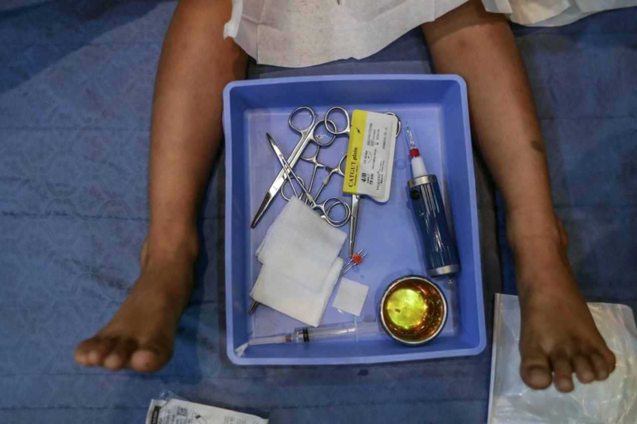 patteggiano genitori neonato morto circonciso reggio emilia