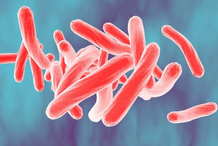 tuberculosis Mycobacterium tuberculosis