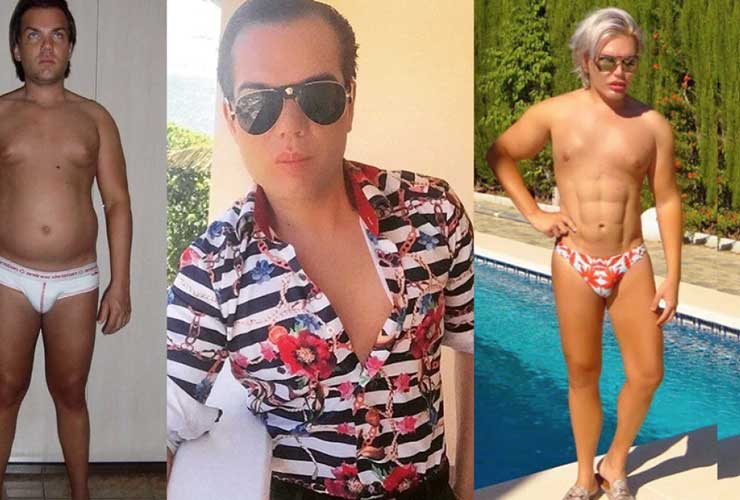 Rodrigo Alves Prima e Dopo