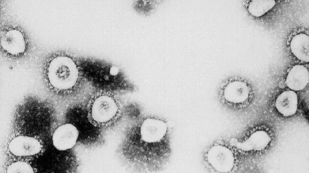 Coronavirus, un gene difettoso farebbe crescere il rischio di contrarlo